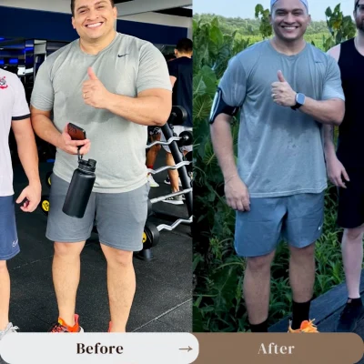 Antes e Depois