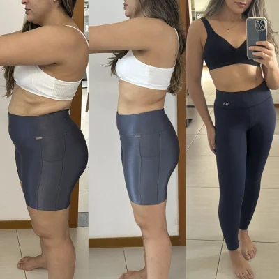 Antes e Depois9